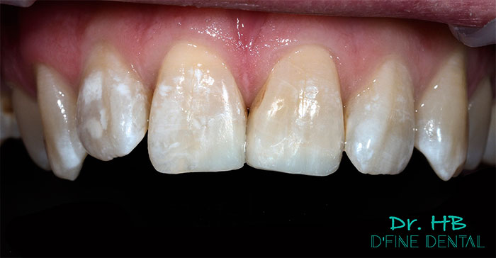 Composite-2.2