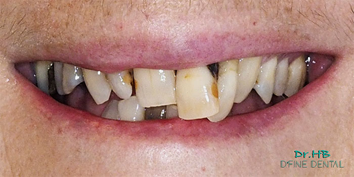 Smile-design-1.1