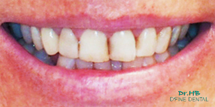 Smile-design-2.1