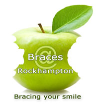 Brace and Invisalign