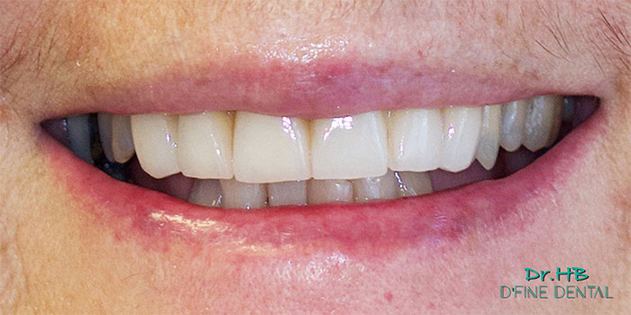 smile-design-1.2