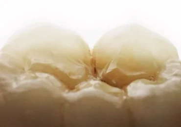 biomimetic